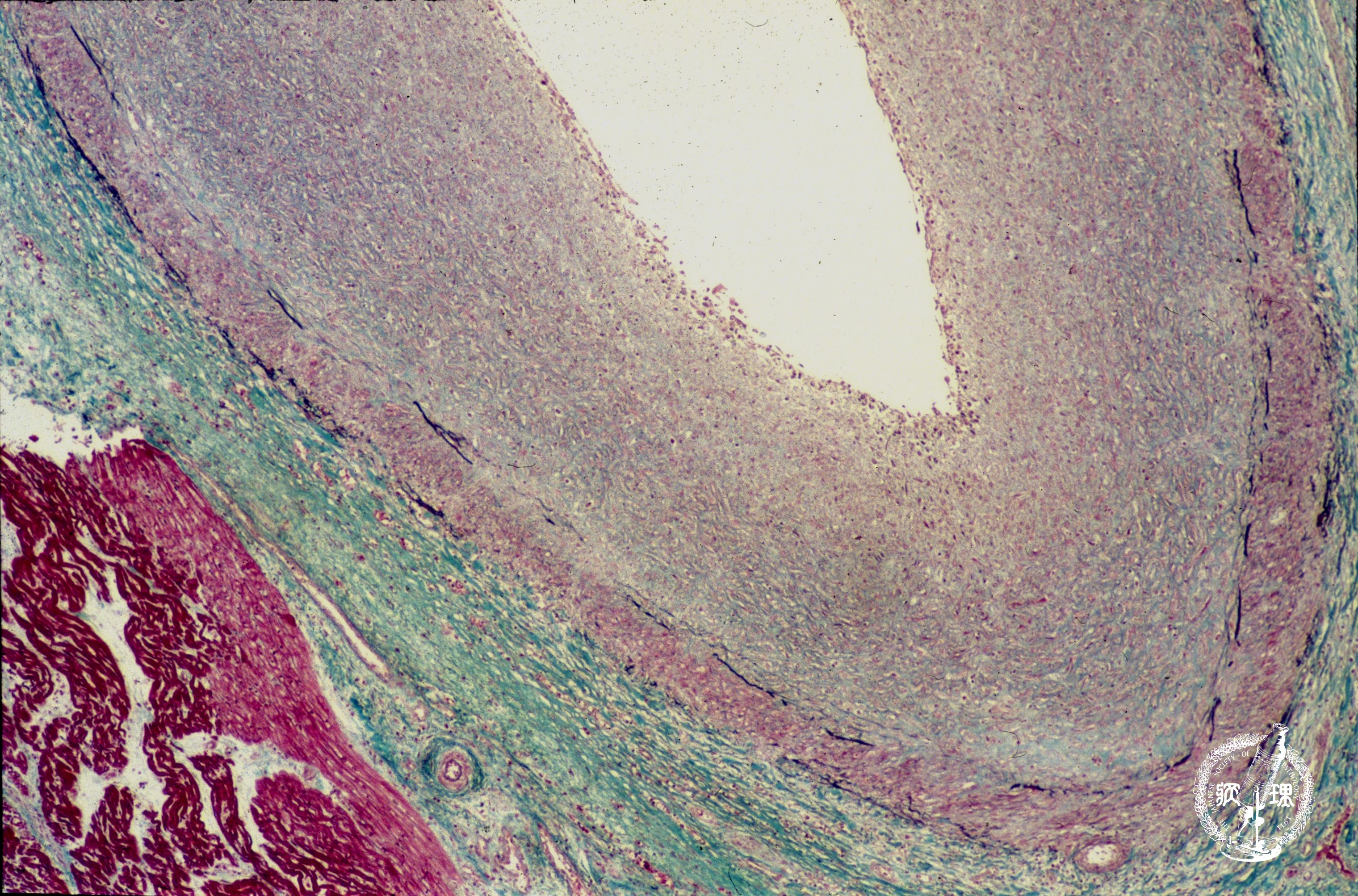 ���a�̊�������