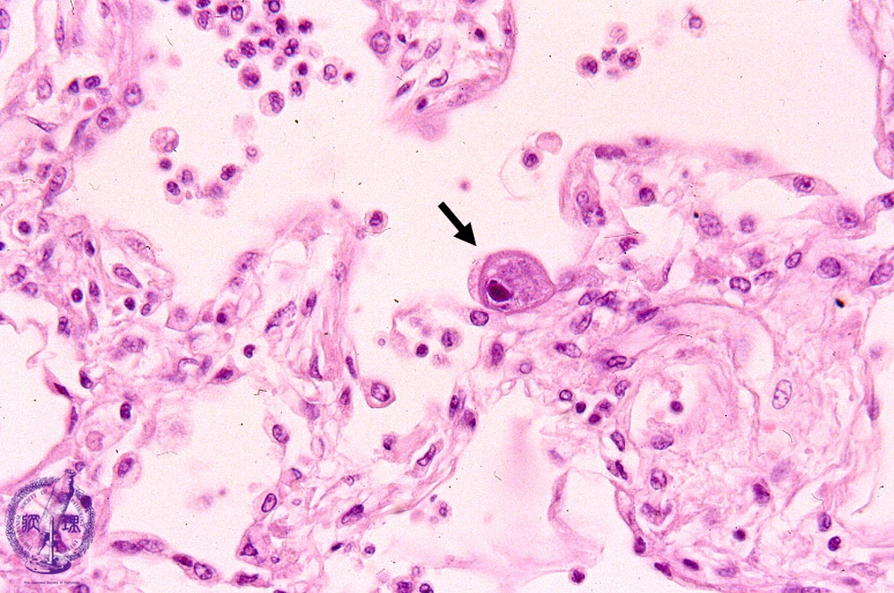 危険因子は何ですか?
