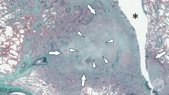 �������ǉ��������ǂ̔x�a��