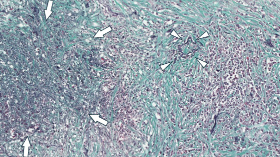 �������ǉ��������ǂ̔x�a��