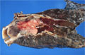 カルチノイド腫瘍マクロ像