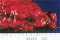 非小細胞肺癌（腺癌）マクロ像（腺癌胸膜切痕）