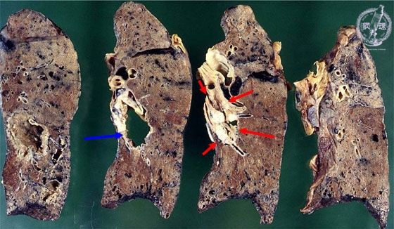 �񏬍זE�x���i�G�������j�}�N����