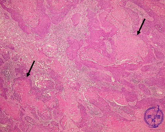 �񏬍זE�x���i�G�������j�~�N�����iHE��g��j