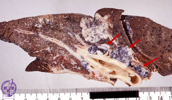 �񏬍זE�x���i�B���j�}�N����