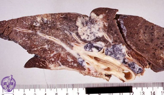 �񏬍זE�x���i�B���j�}�N����