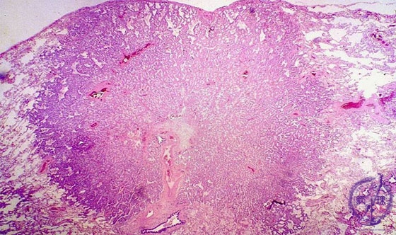 �񏬍זE�x���i�B���j�~�N�����iHE��g��j