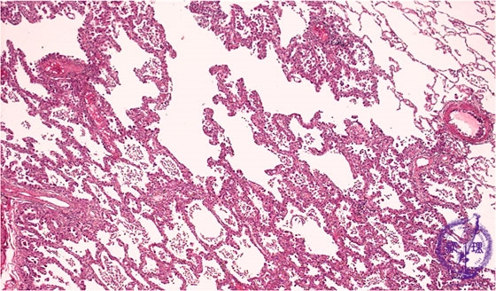 �񏬍זE�x���i�B���j�~�N�����iHE��g��j