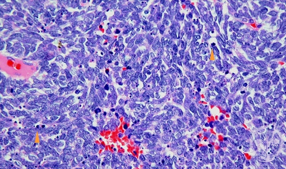 ���זE���~�N�����iHE���g��j