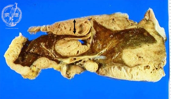 ���������}�N����