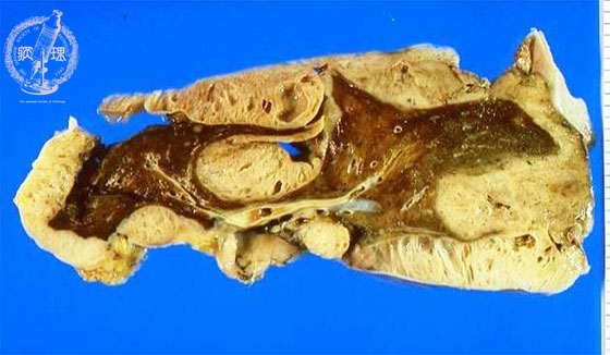 ���������}�N����