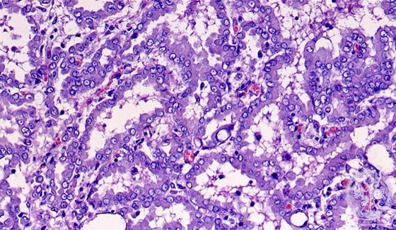 ���������~�N�����iHE���g��j