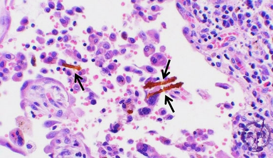 ���������~�N�����iHE��g��j