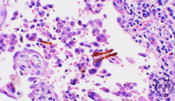 ���������~�N�����iHE��g��j