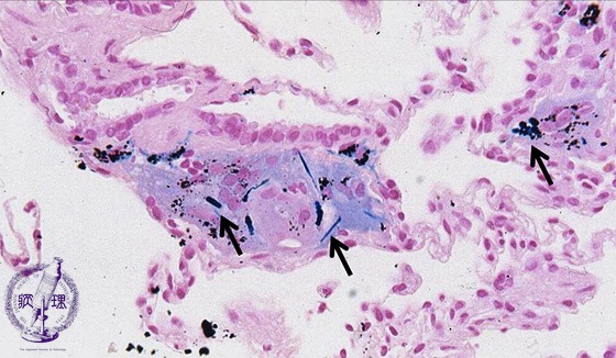 ���������~�N�����i�S���F���g��j