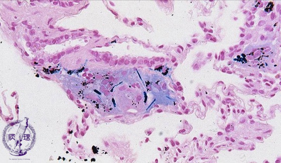 ���������~�N�����i�S���F���g��j