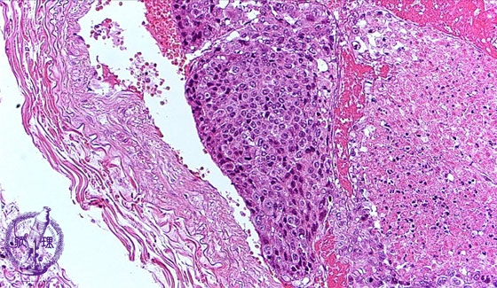 �]�ڐ��x��ᇃ~�N�����iHE���g��j