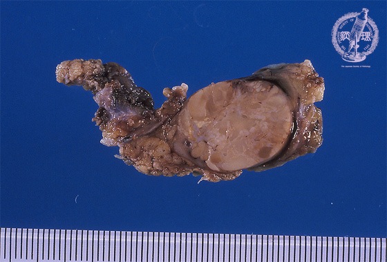 ���t�B��ᇁi�����`����ᇁj�}�N����