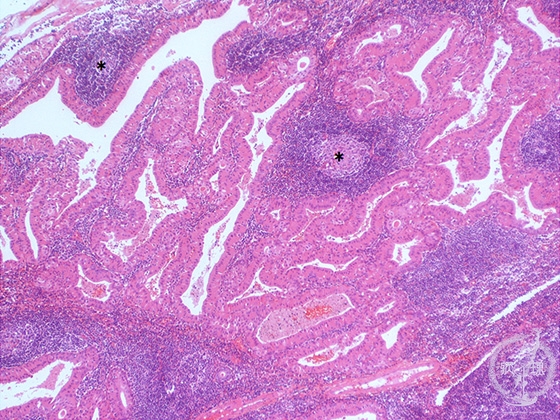 ���t�B��ᇁi�����`����ᇁj�~�N�����iHE��g��j