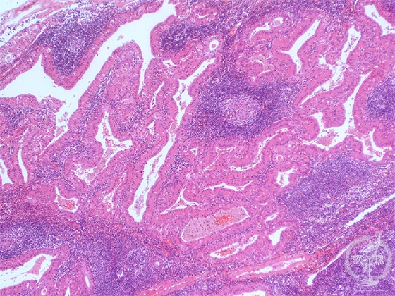 ���t�B��ᇁi�����`����ᇁj�~�N�����iHE��g��j