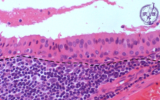 ���t�B��ᇁi�����`����ᇁj�~�N�����iHE���g��j