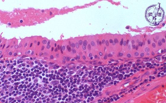 ���t�B��ᇁi�����`����ᇁj�~�N�����iHE���g��j