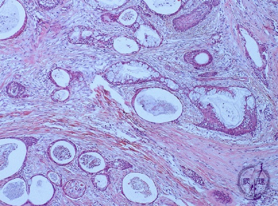 ���t�B��ᇁi�S�\����j