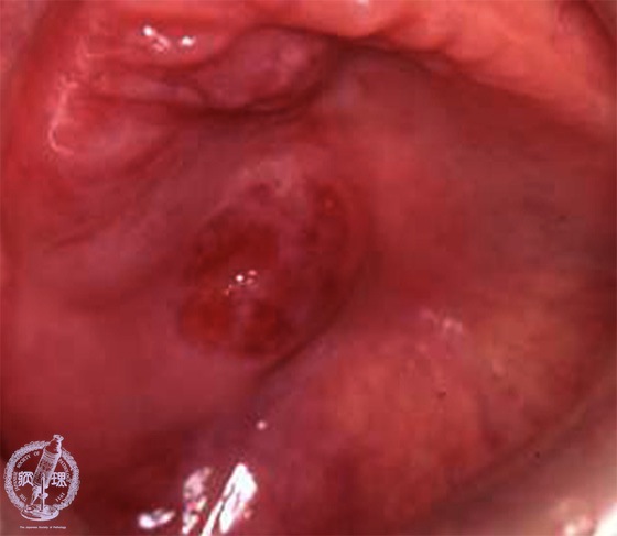 ���t�B��ᇁi�B�l�X�E���j�}�N����