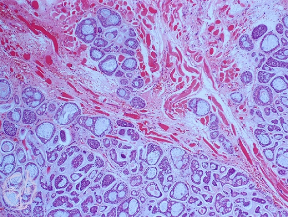 ���t�B��ᇁi�B�l�X�E���j�~�N�����iHE��g��j