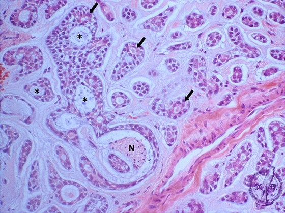 ���t�B��ᇁi�B�l�X�E���j�~�N�����iHE���g��j