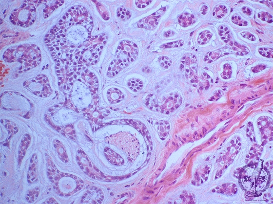 ���t�B��ᇁi�B�l�X�E���j�~�N�����iHE���g��j