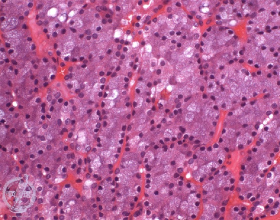 ���t�B��ᇁi�B�[�זE���j