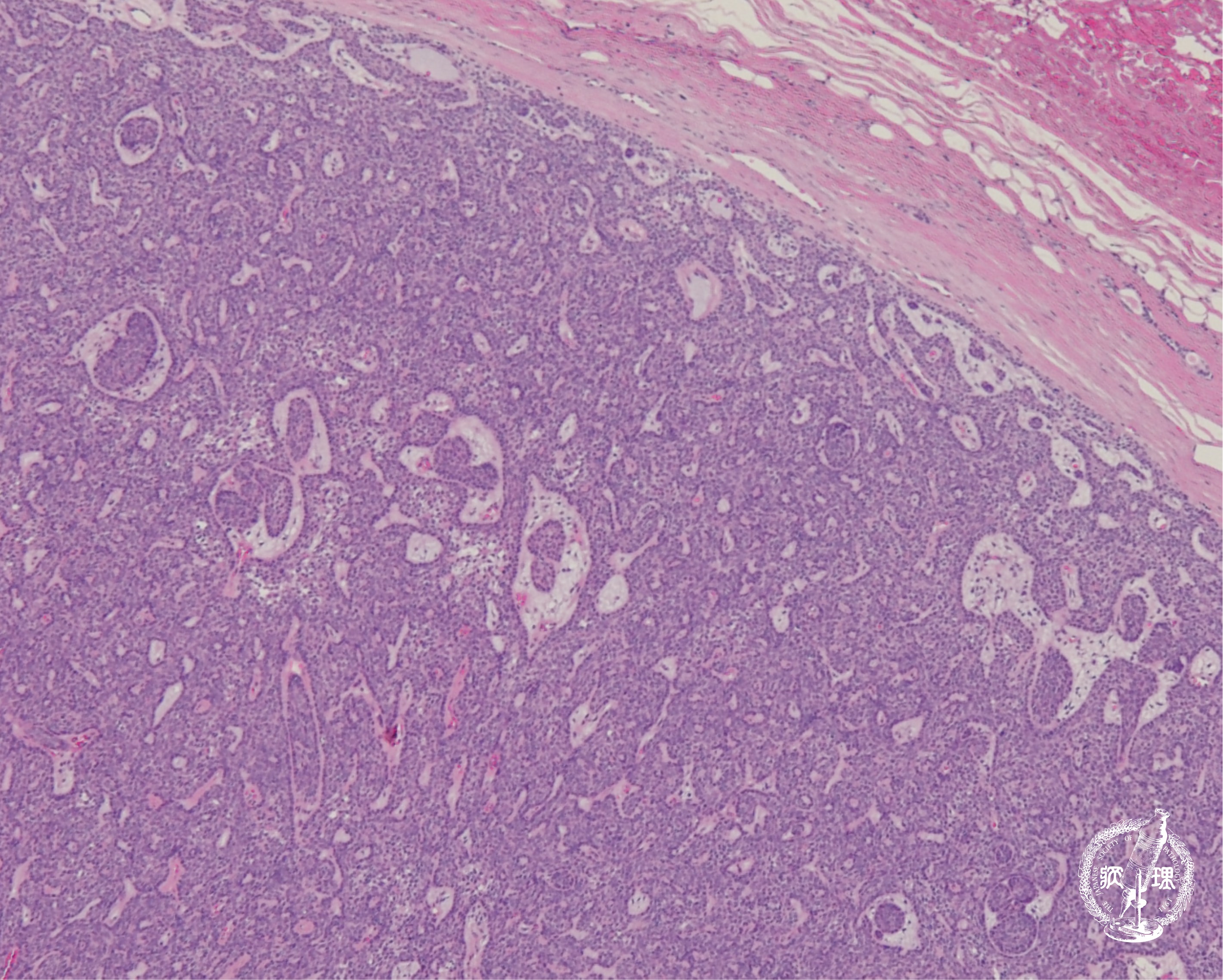 ���t�B��� (���זE�B��)