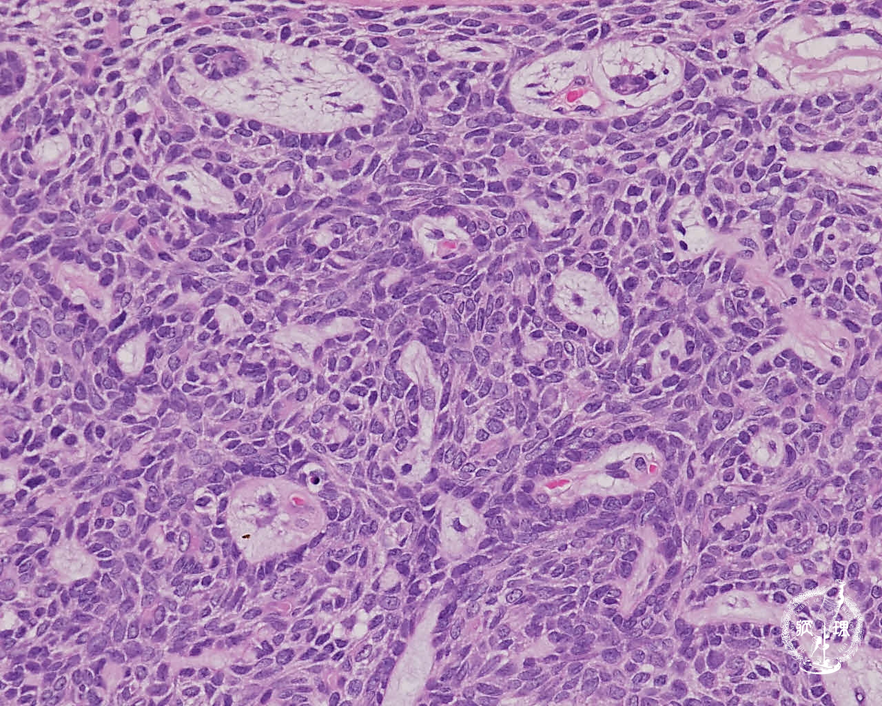 ���t�B��� (���זE�B��)