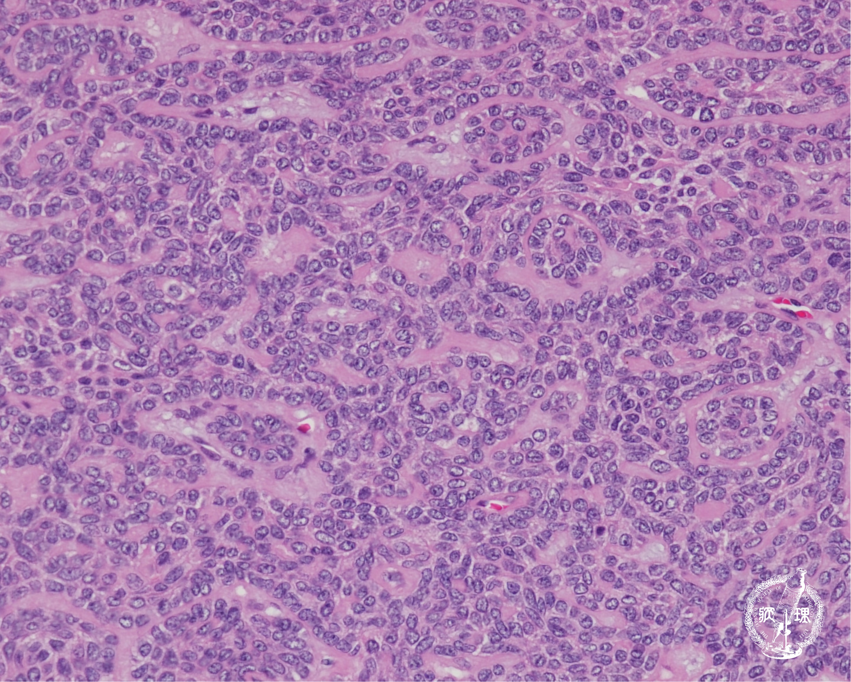 ���t�B��� (���זE�B��)