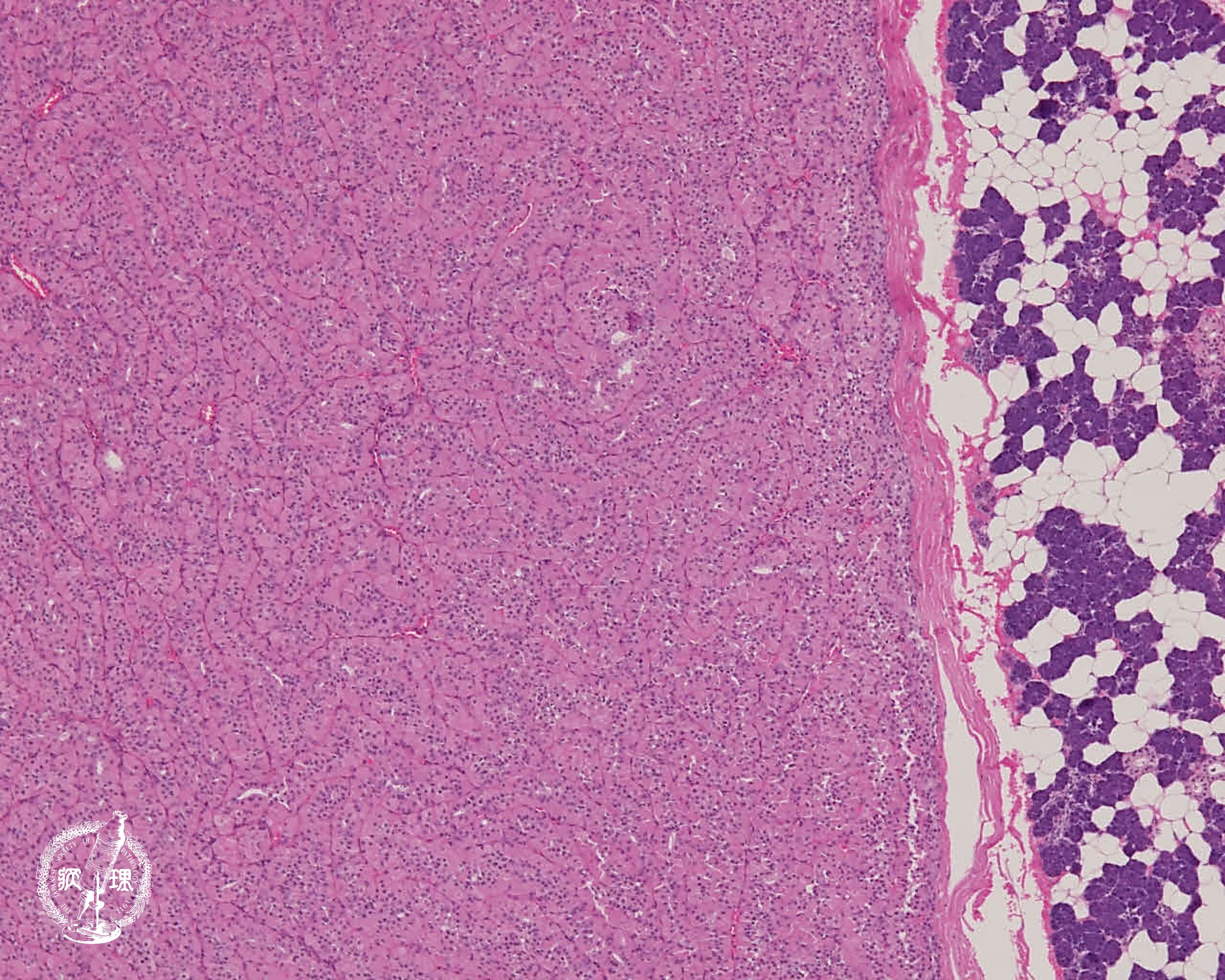 ���t�B��� (�I���R�T�C�g�[�})