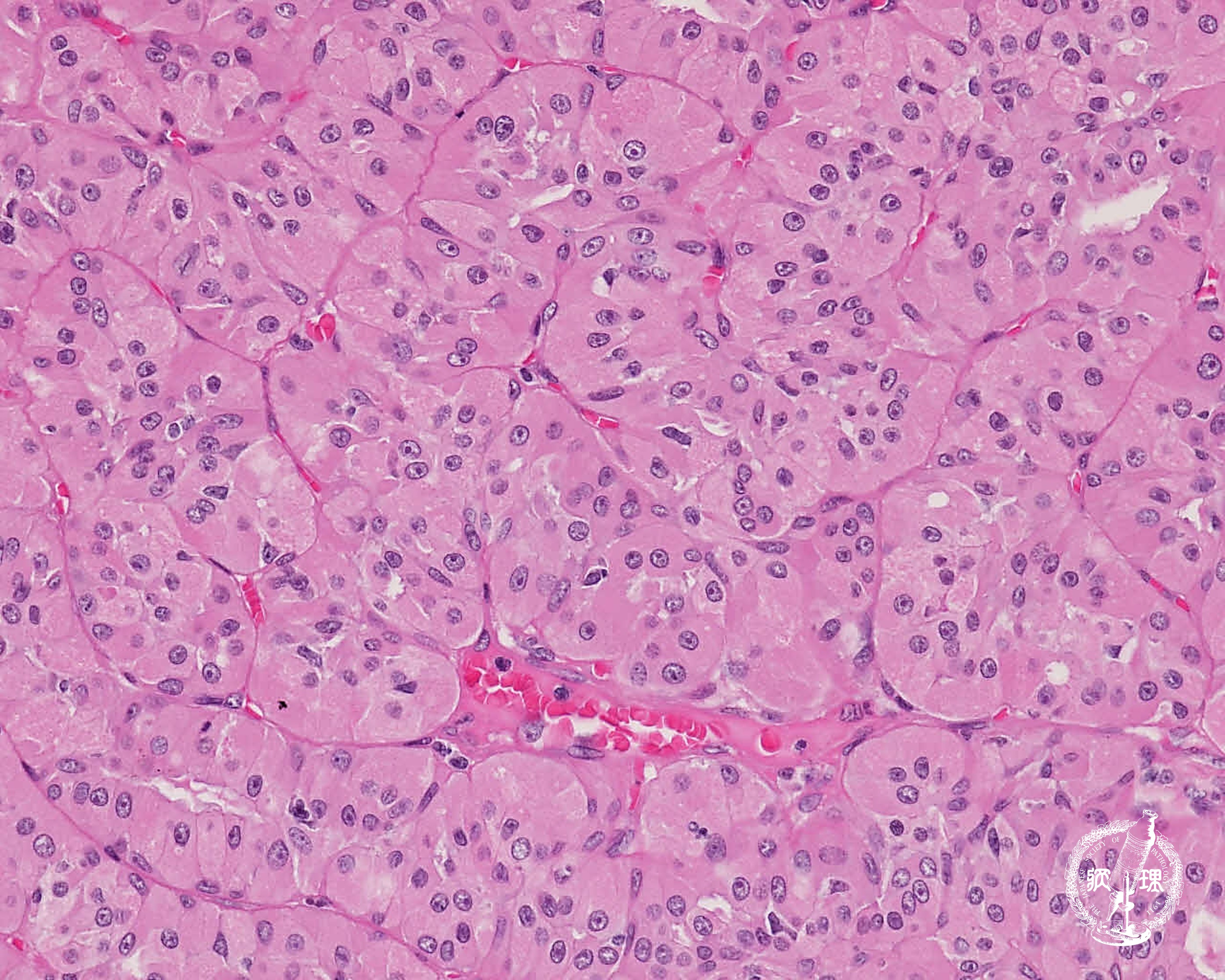 ���t�B��� (�I���R�T�C�g�[�})