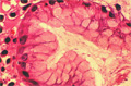 胃炎（H.pylori感染）ミクロ像（HE弱拡大）