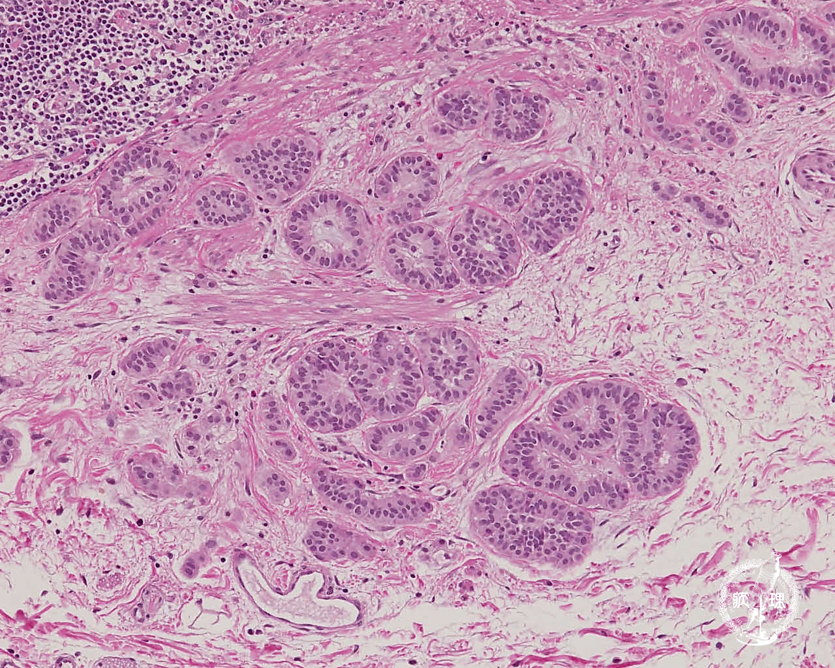 �咰�J���`�m�C�h���