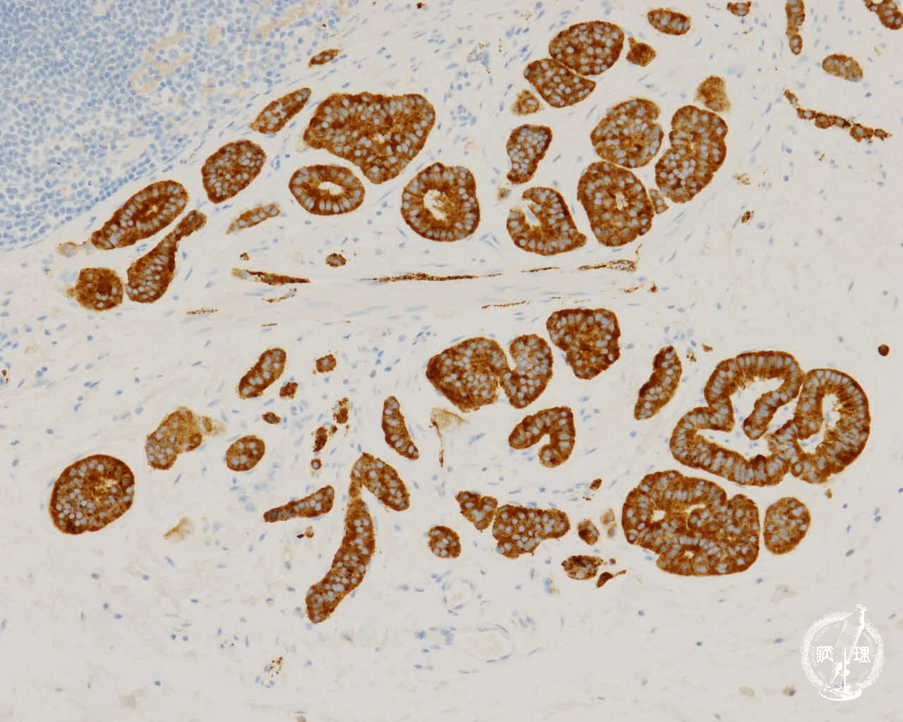 �咰�J���`�m�C�h���