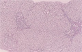慢性ウイルス性肝炎ミクロ像（渡銀染色中拡大）