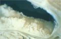 膵粘液性腫瘍（IPMT, MCT）マクロ像（切除材料実体顕微鏡観察像）