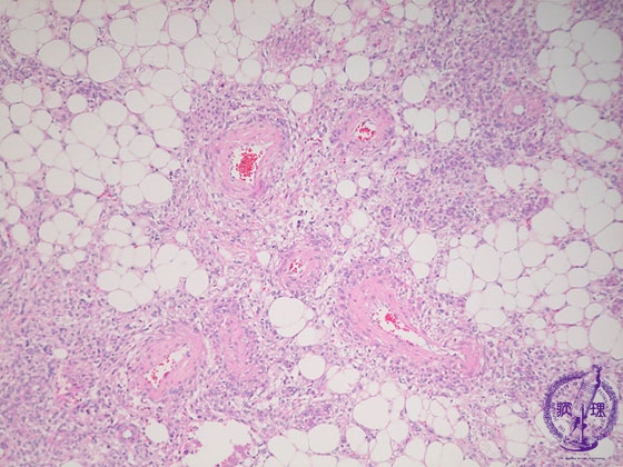 �t���Ǖ����؎��b��i���ߐ��d���ǁj�~�N�����iHE���g��j