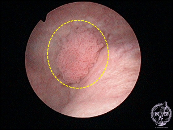 �A�H�����i�ڍs�����j�}�N����