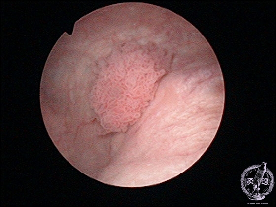 �A�H�����i�ڍs�����j�}�N����