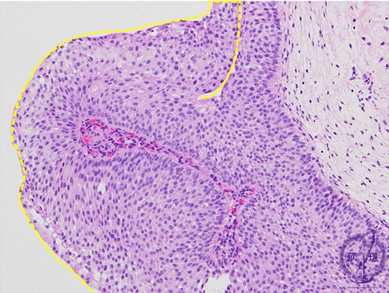 �A�H�����i�ڍs�����A�f�P�j�~�N�����iHE���g��j