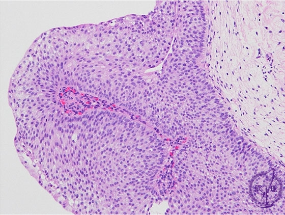 �A�H�����i�ڍs�����A�f�P�j�~�N�����iHE���g��j