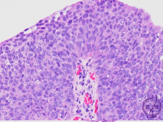 �A�H�����i�ڍs�����A�f�R�j�~�N�����iHE���g��j