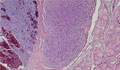 ２次性副甲状腺過形成ミクロ像（HE弱拡大）