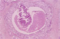 非浸潤性乳管癌（面疱型）ミクロ像（HE強拡大）